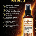 Spray Anti Hongos – Con Veneno de Abeja Natural 🐝